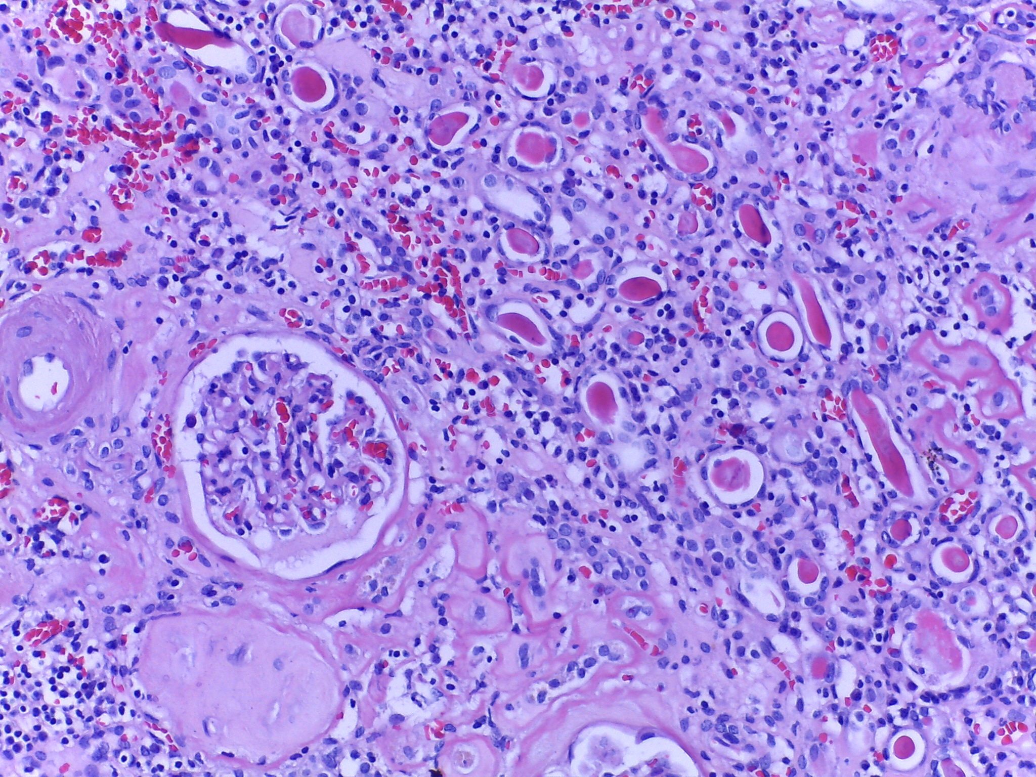 PR 323 Kidney and Urinary system